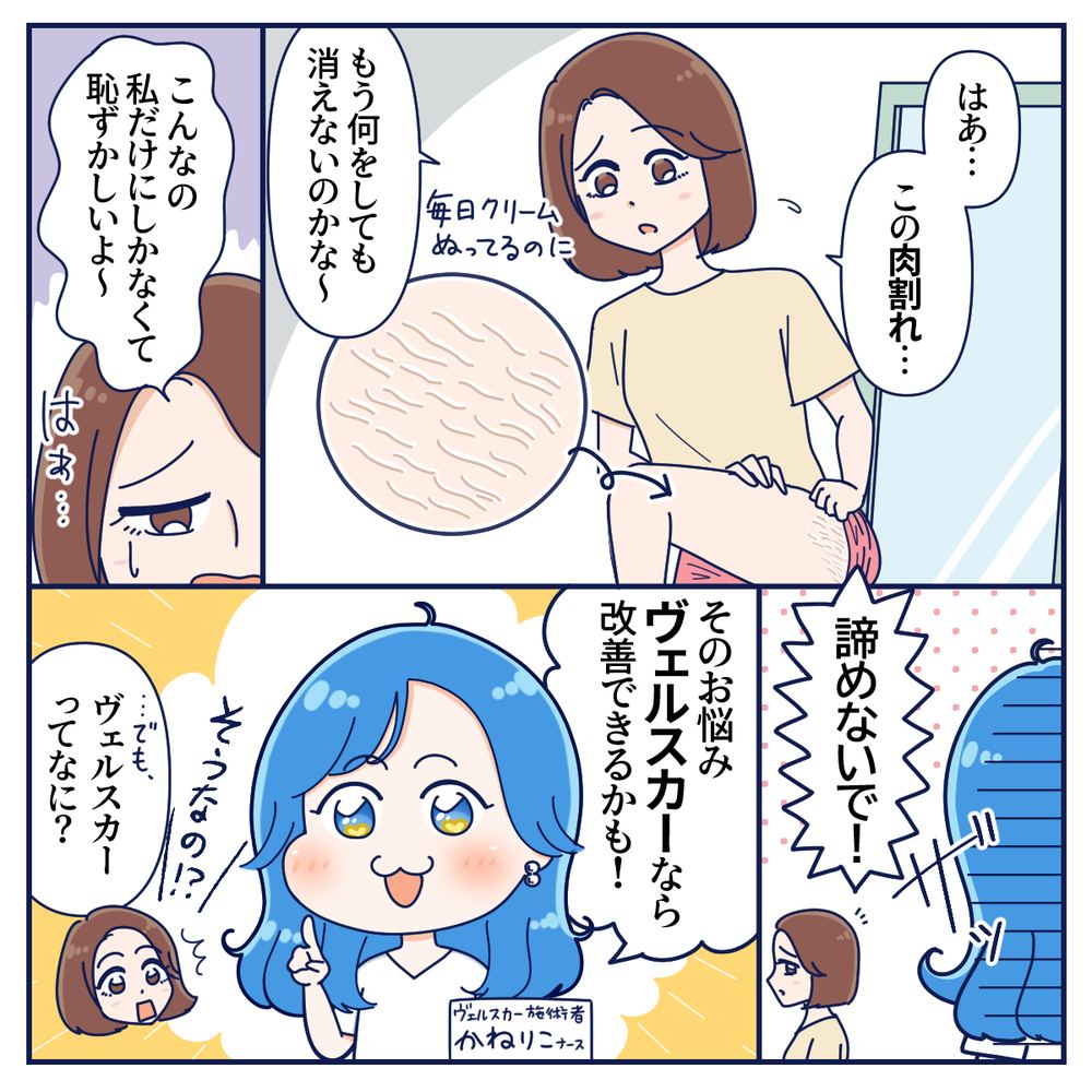 ヴェルスカー 肉割れ改善 PR漫画