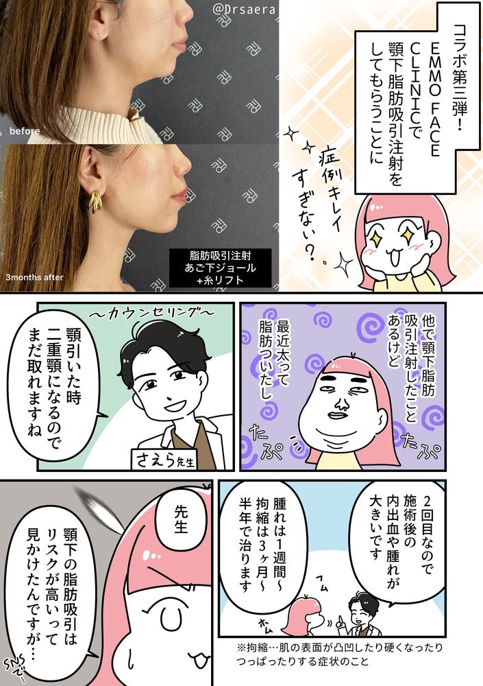 EMMO FACE CLINIC 顎下脂肪吸引レポ PR漫画